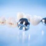 1745478324_OBA6DRyPM1