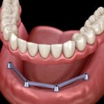 1745484835_4qtBhm2k4a